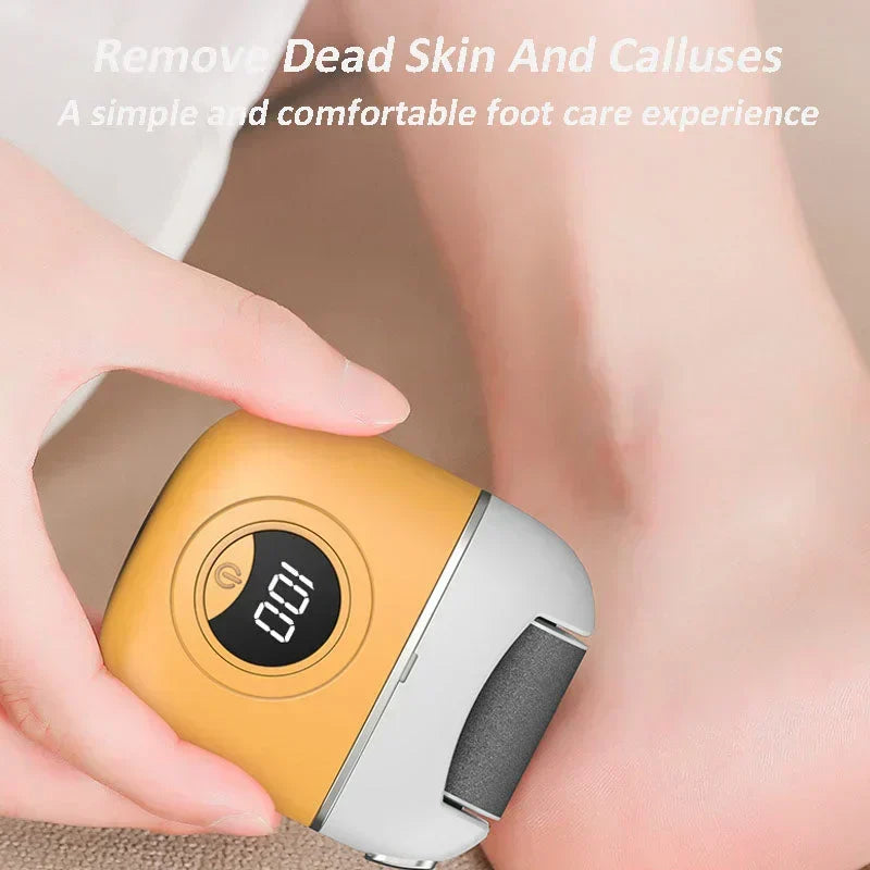 🎉 2026 Flash Sale — Over 80,000 Sold! 🔥 USB Rechargeable Electric Foot Callus Remover – 3‑Speed Grinding & LED Light 👣